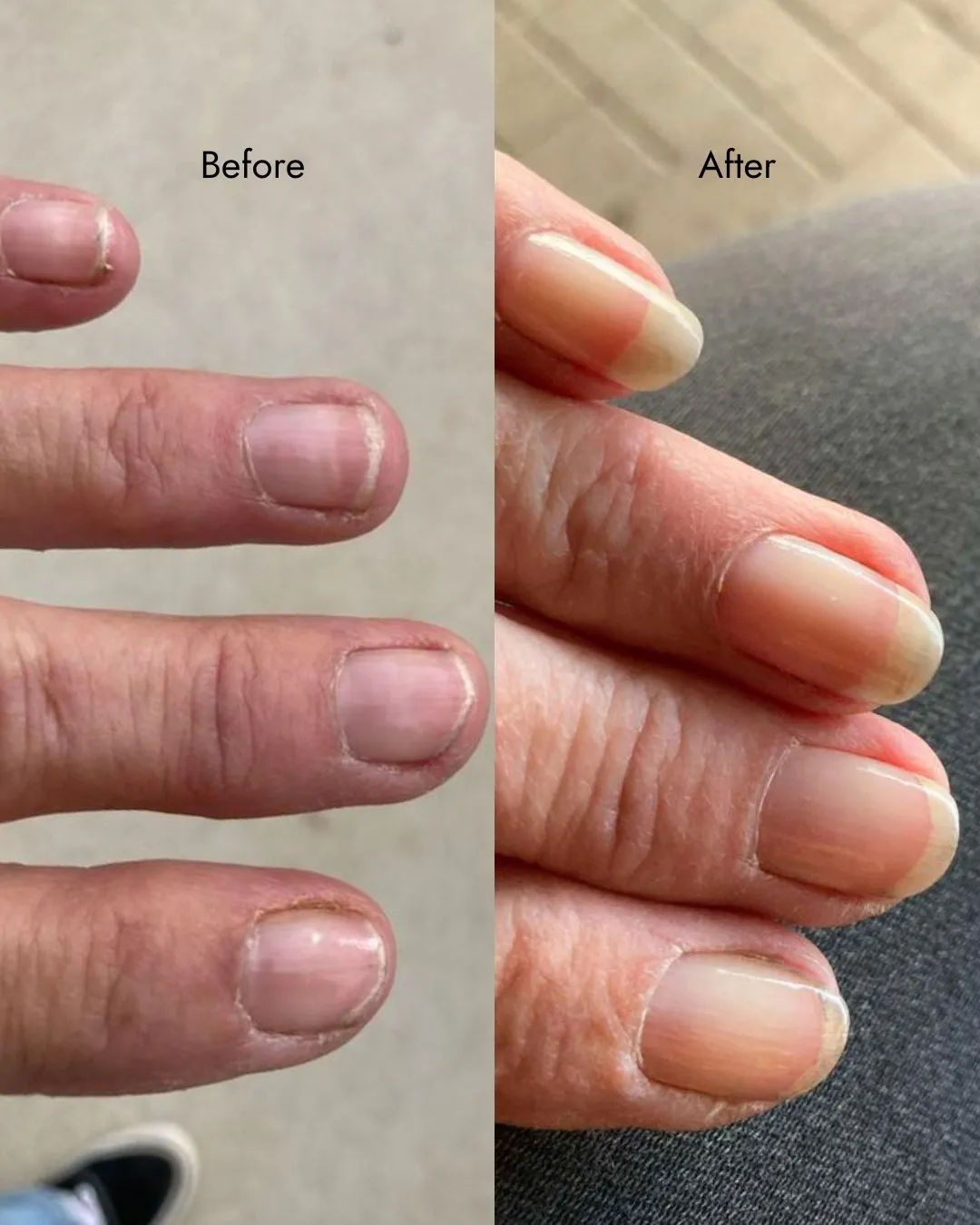 Ultimate Nail Strengthening Kit